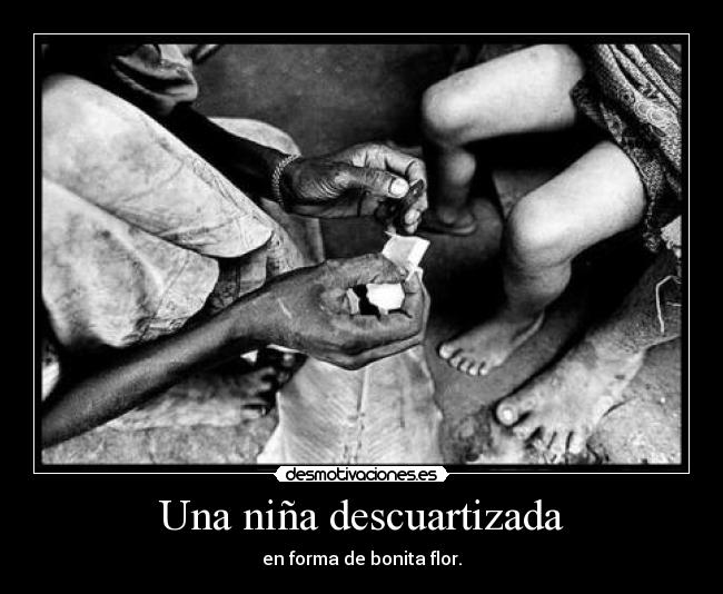 Una niña descuartizada - en forma de bonita flor.