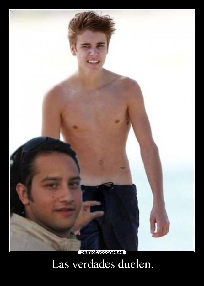 Las verdades duelen. - 