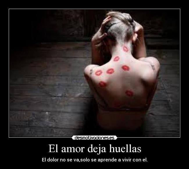 El amor deja huellas - El dolor no se va,solo se aprende a vivir con el.