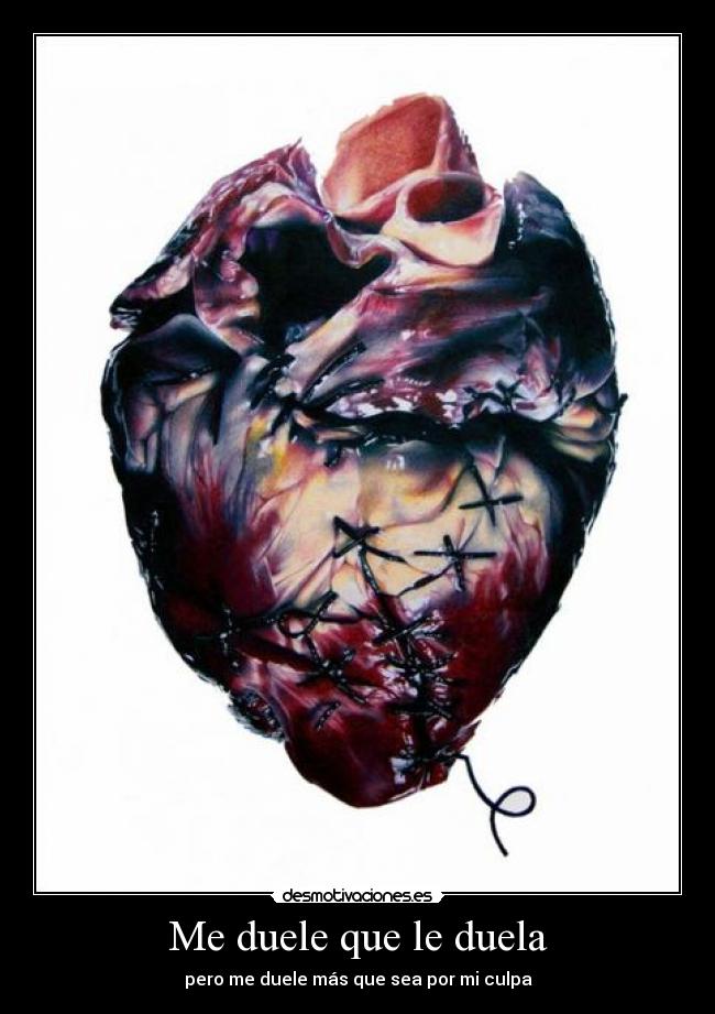 Me duele que le duela - 