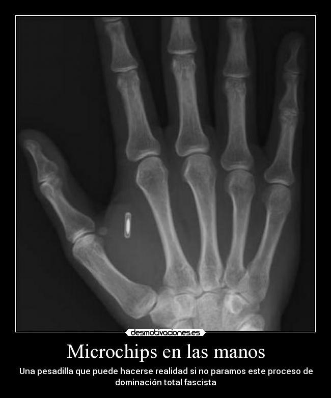 Microchips en las manos - 