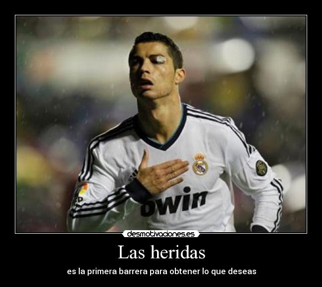 Las heridas - es la primera barrera para obtener lo que deseas