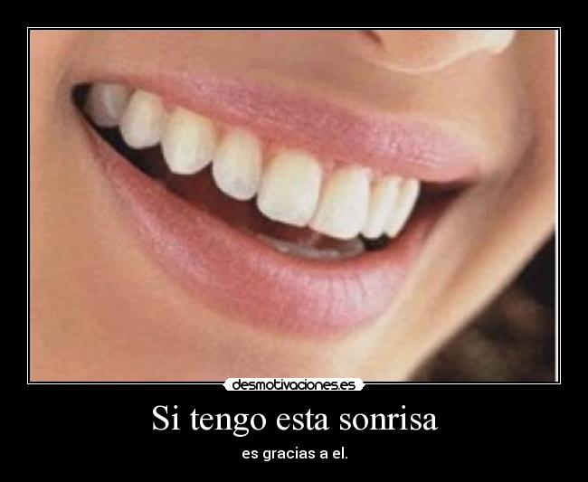 Si tengo esta sonrisa -