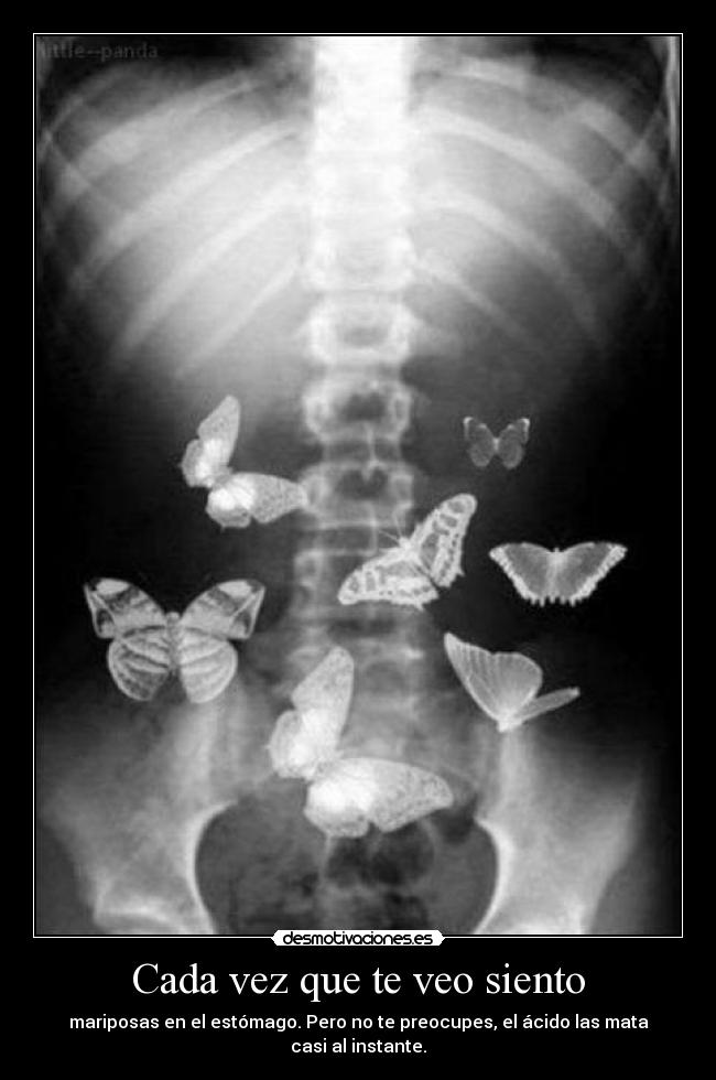 Cada vez que te veo siento - 