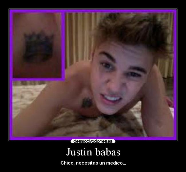 Justin babas - 