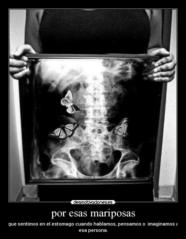 por esas mariposas - que sentimos en el estomago cuando hablamos, pensamos o imaginamos a
esa persona.