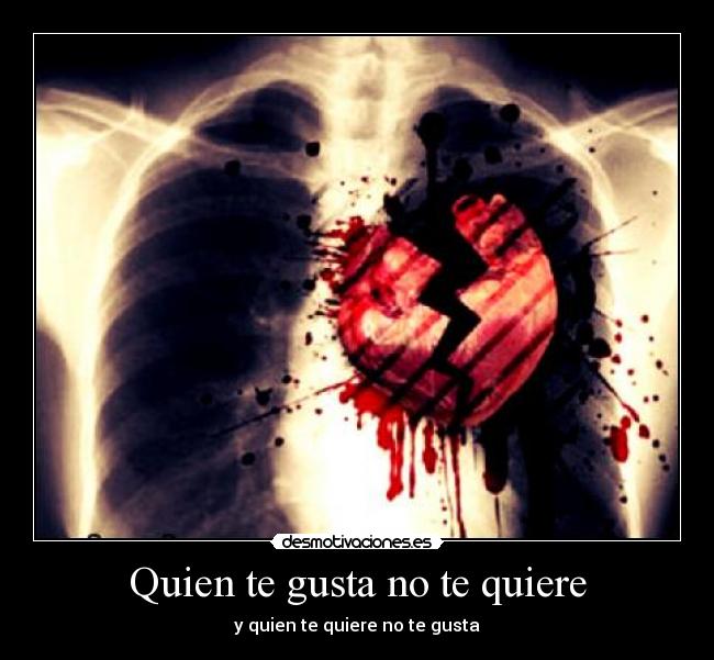 Quien te gusta no te quiere - y quien te quiere no te gusta