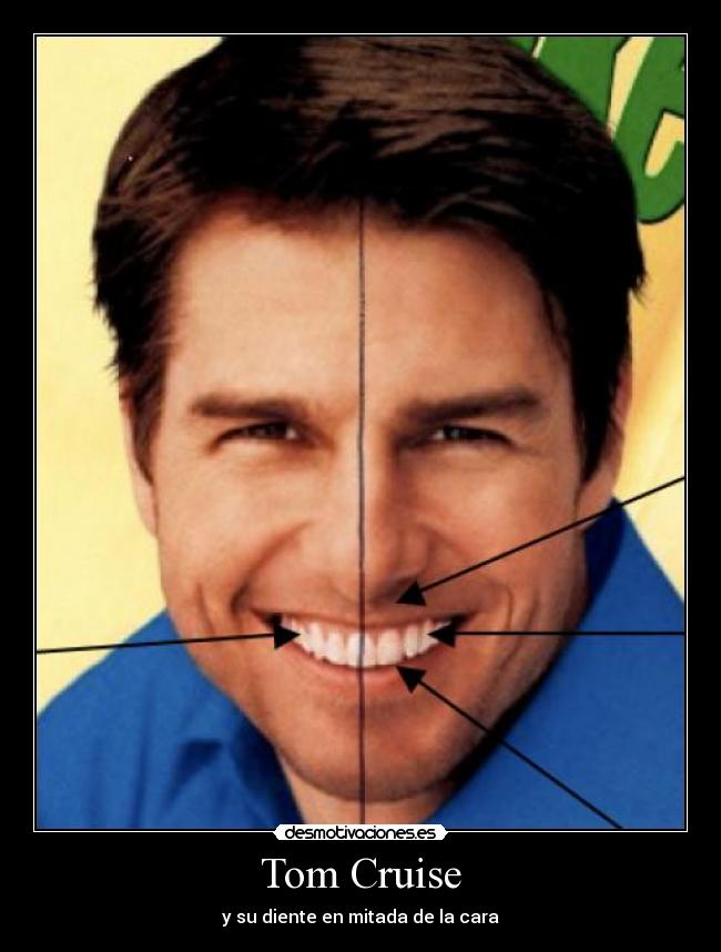 Tom Cruise - y su diente en mitada de la cara