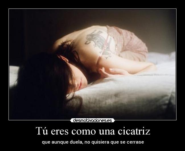 Tú eres como una cicatriz -