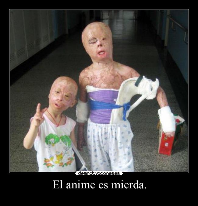 El anime es mierda. -