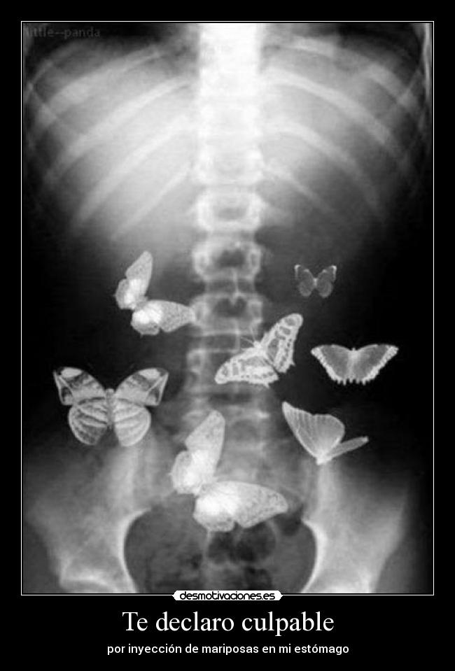 Te declaro culpable - por inyección de mariposas en mi estómago