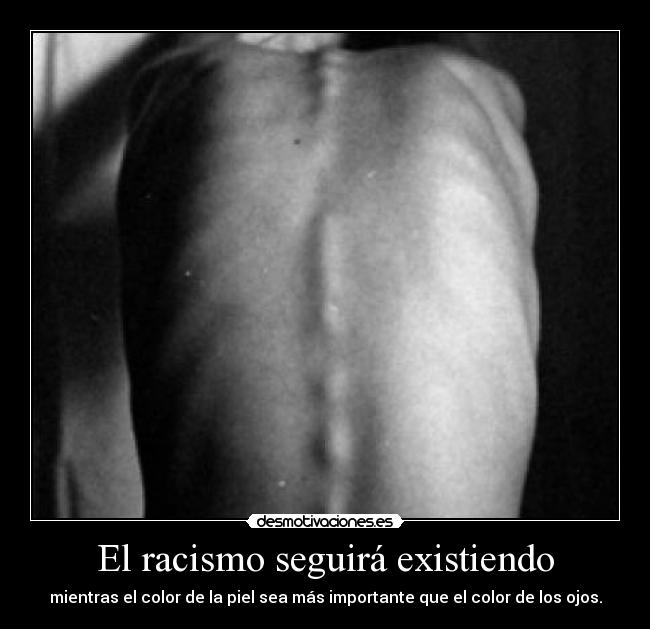 El racismo seguirá existiendo - mientras el color de la piel sea más importante que el color de los ojos.