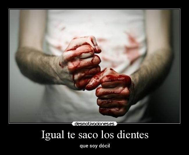 Igual te saco los dientes - 
