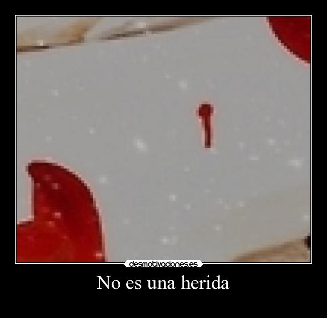 No es una herida - 