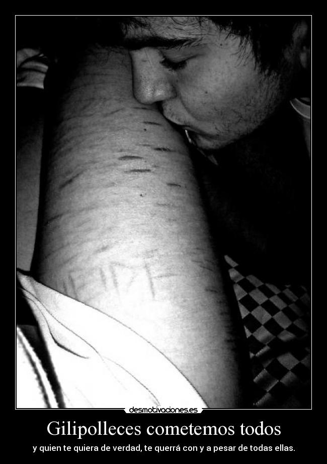 Gilipolleces cometemos todos - y quien te quiera de verdad, te querrá con y a pesar de todas ellas.