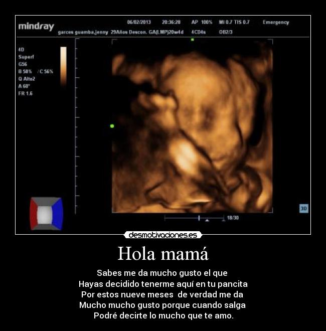 Hola mamá - 