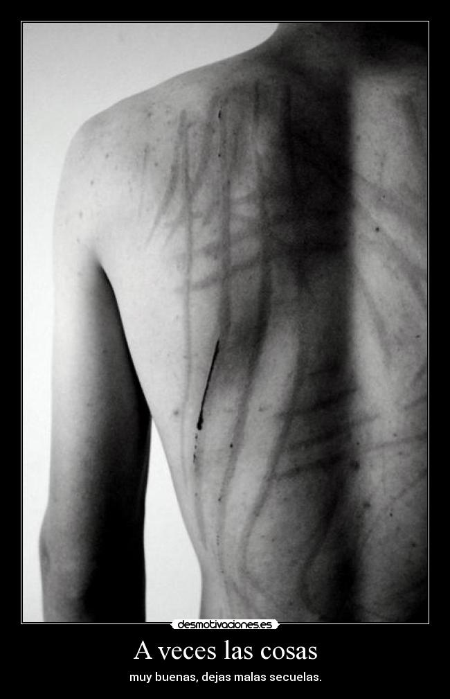 A veces las cosas - muy buenas, dejas malas secuelas.