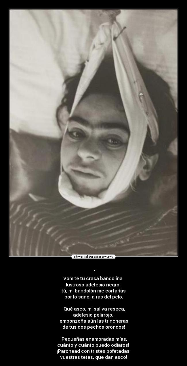 . - Vomité tu crasa bandolina
lustroso adefesio negro:
tú, mi bandolón me cortarías
por lo sano, a ras del pelo.
¡Qué asco, mi saliva reseca,
adefesio pelirrojo,
emponzoña aún las trincheras
de tus dos pechos orondos!
¡Pequeñas enamoradas mías,
cuánto y cuánto puedo odiaros!
¡Parchead con tristes bofetadas
vuestras tetas, que dan asco!