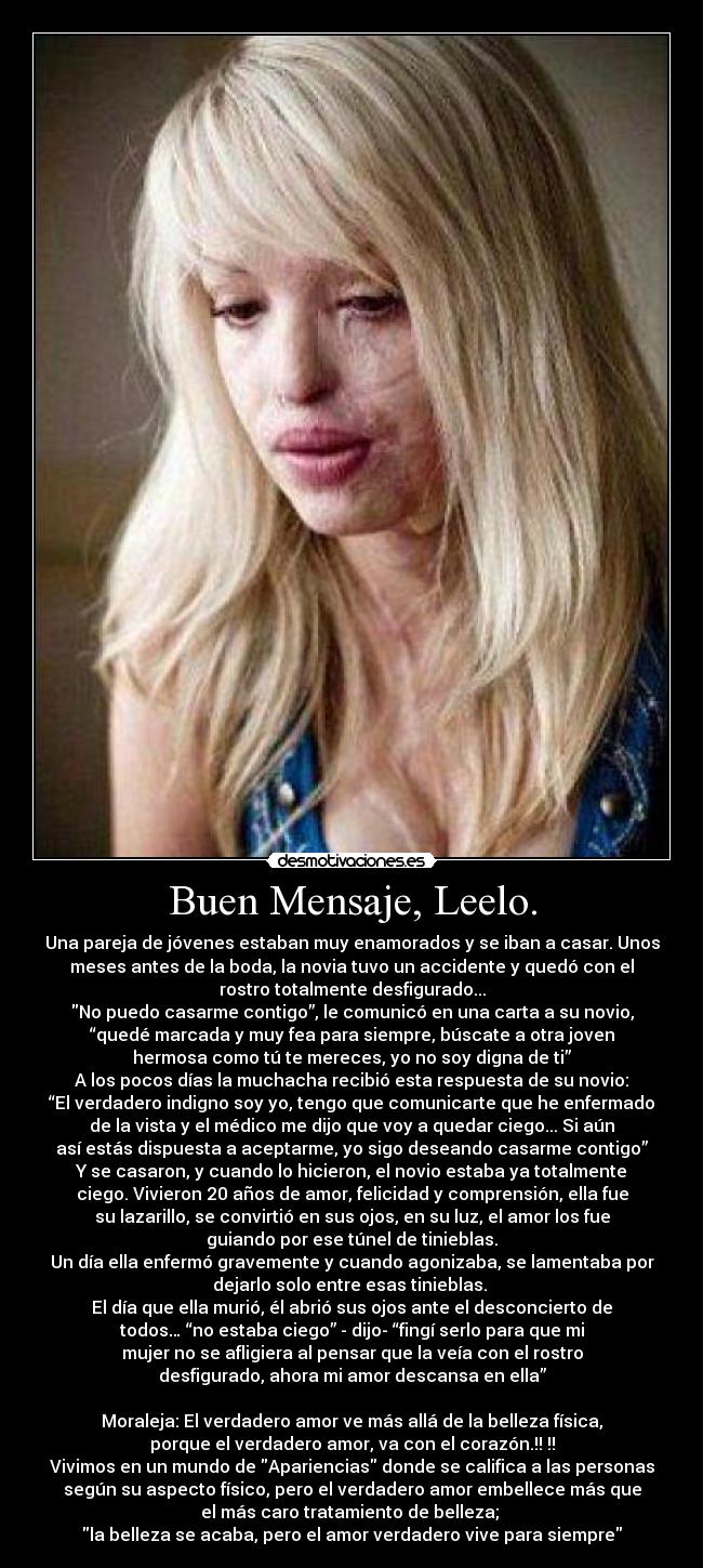 Buen Mensaje, Leelo. - Una pareja de jóvenes estaban muy enamorados y se iban a casar. Unos
meses antes de la boda, la novia tuvo un accidente y quedó con el
rostro totalmente desfigurado...
No puedo casarme contigo”, le comunicó en una carta a su novio,
“quedé marcada y muy fea para siempre, búscate a otra joven
hermosa como tú te mereces, yo no soy digna de ti”
A los pocos días la muchacha recibió esta respuesta de su novio:
“El verdadero indigno soy yo, tengo que comunicarte que he enfermado
de la vista y el médico me dijo que voy a quedar ciego... Si aún
así estás dispuesta a aceptarme, yo sigo deseando casarme contigo”
Y se casaron, y cuando lo hicieron, el novio estaba ya totalmente
ciego. Vivieron 20 años de amor, felicidad y comprensión, ella fue
su lazarillo, se convirtió en sus ojos, en su luz, el amor los fue
guiando por ese túnel de tinieblas.
Un día ella enfermó gravemente y cuando agonizaba, se lamentaba por
dejarlo solo entre esas tinieblas.
El día que ella murió, él abrió sus ojos ante el desconcierto de
todos… “no estaba ciego” - dijo- “fingí serlo para que mi
mujer no se afligiera al pensar que la veía con el rostro
desfigurado, ahora mi amor descansa en ella”
Moraleja: El verdadero amor ve más allá de la belleza física,
porque el verdadero amor, va con el corazón.!!♥!!
Vivimos en un mundo de Apariencias donde se califica a las personas
según su aspecto físico, pero el verdadero amor embellece más que
el más caro tratamiento de belleza;
la belleza se acaba, pero el amor verdadero vive para siempre