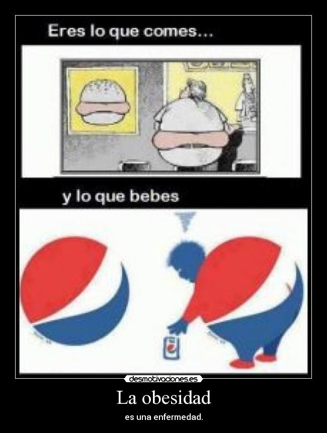 La obesidad -