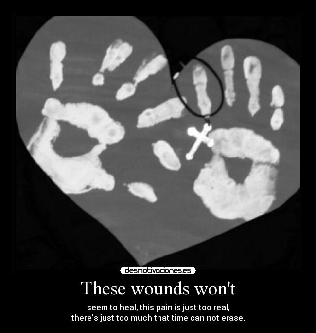 These wounds wont - seem to heal, this pain is just too real,
theres just too much that time can not erase.