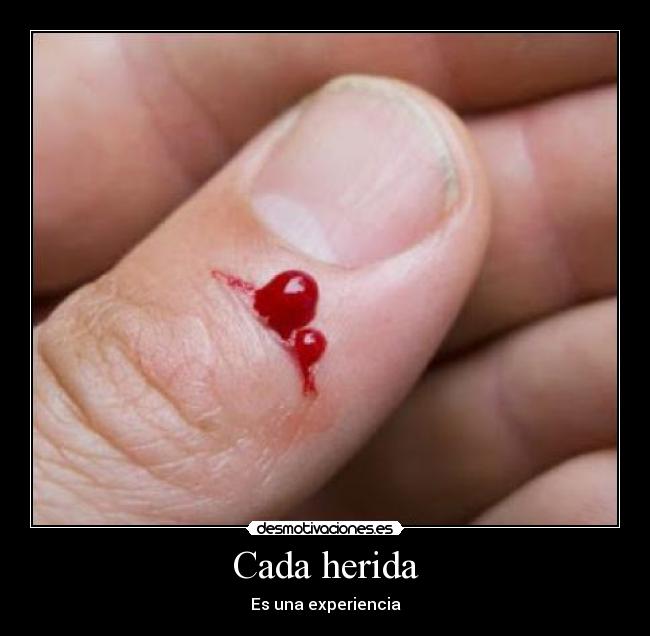 Cada herida -