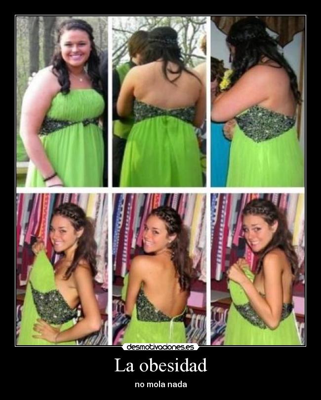 La obesidad - no mola nada