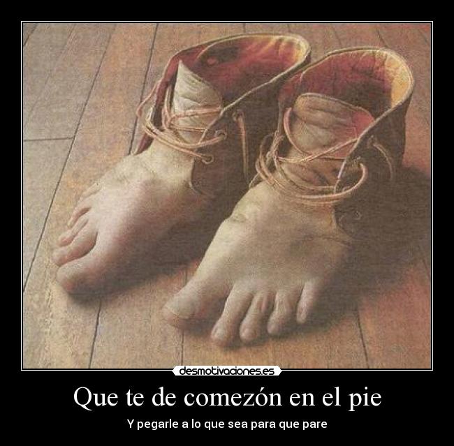 que te de comezón en el pie desmotivaciones