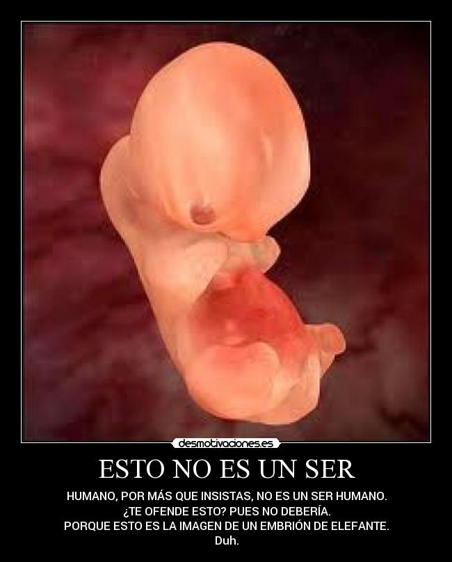 ESTO NO ES UN SER - HUMANO, POR MÁS QUE INSISTAS, NO ES UN SER HUMANO.
¿TE OFENDE ESTO? PUES NO DEBERÍA.
PORQUE ESTO ES LA IMAGEN DE UN EMBRIÓN DE ELEFANTE.
Duh.