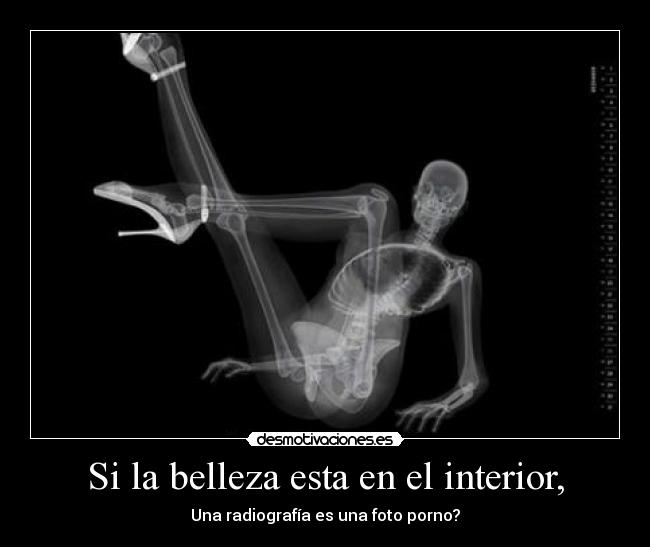 Si la belleza esta en el interior, - Una radiografía es una foto porno?