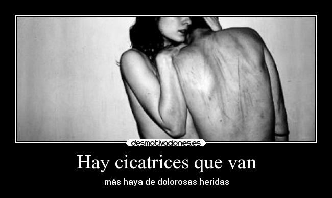 Hay cicatrices que van -