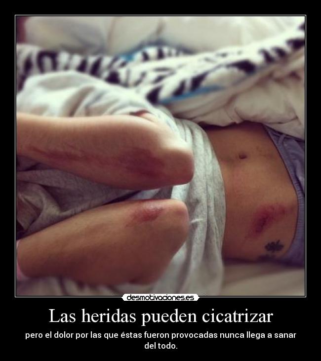 Las heridas pueden cicatrizar - pero el dolor por las que éstas fueron provocadas nunca llega a sanar del todo.