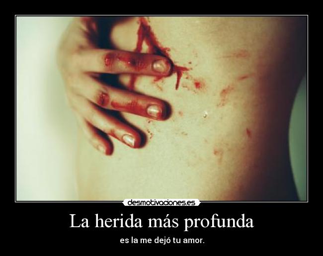 La herida más profunda - es la me dejó tu amor.