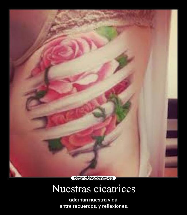 Nuestras cicatrices - adornan nuestra vida
entre recuerdos, y reflexiones.