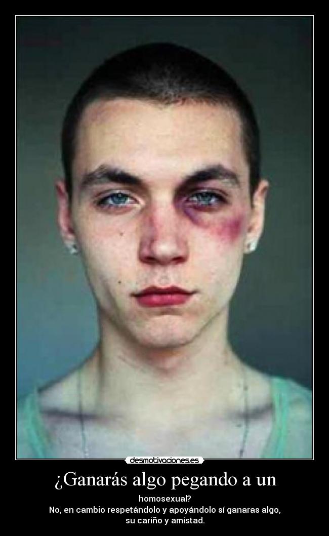 ¿Ganarás algo pegando a un - homosexual?
No, en cambio respetándolo y apoyándolo sí ganaras algo,
su cariño y amistad.