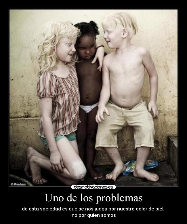 Uno de los problemas - de esta sociedad es que se nos judga por nuestro color de piel,
no por quien somos
