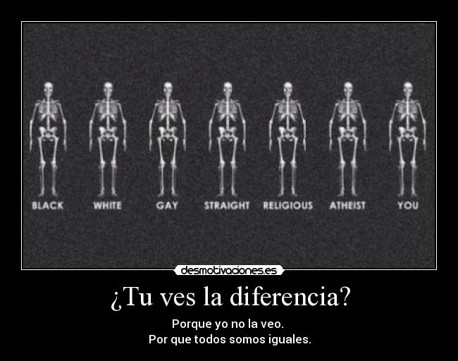 ¿Tu ves la diferencia? -