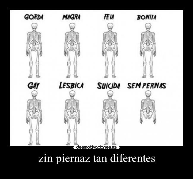 zin piernaz tan diferentes -