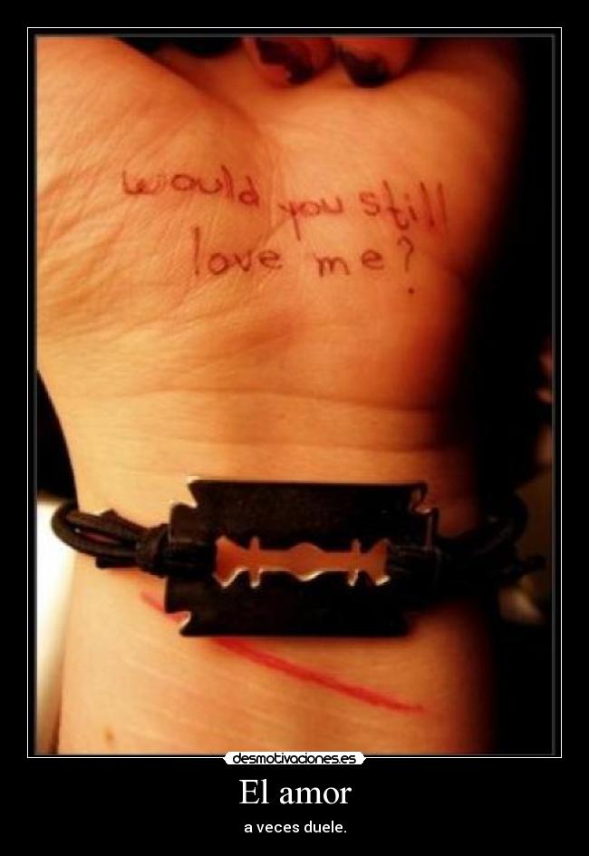 El amor - a veces duele.