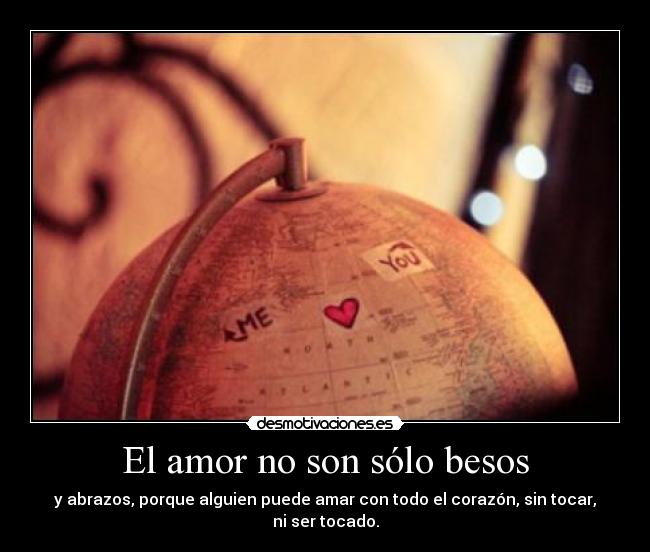 El amor no son sólo besos - 