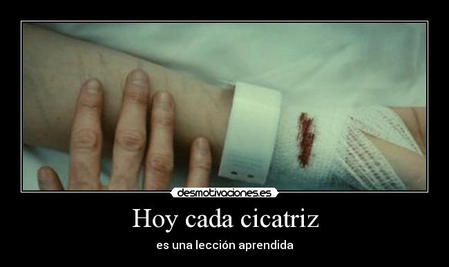 Hoy cada cicatriz -