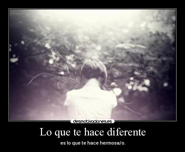 Lo que te hace diferente - es lo que te hace hermosa/o.