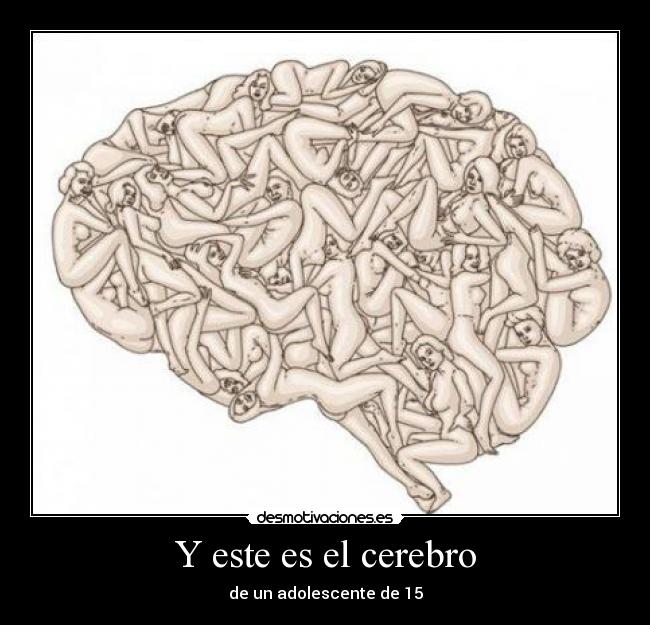 Y este es el cerebro - de un adolescente de 15