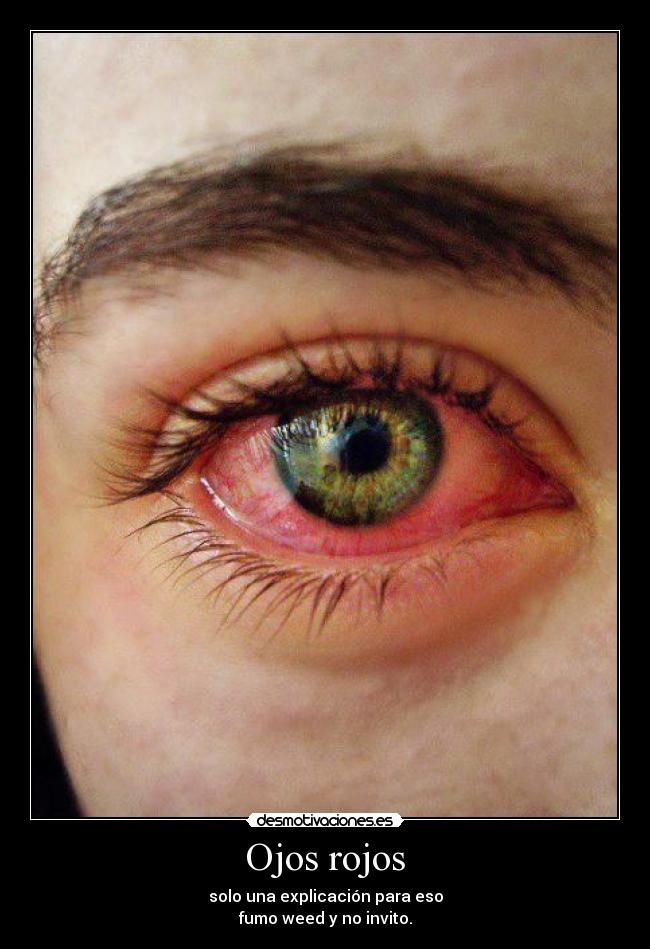 Ojos rojos Desmotivaciones