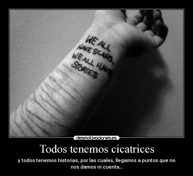Todos tenemos cicatrices - 