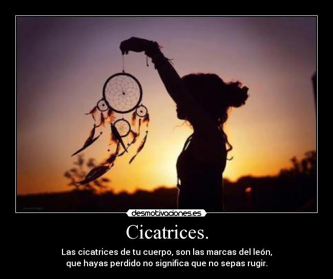 Cicatrices. - Las cicatrices de tu cuerpo, son las marcas del león,
que hayas perdido no significa que no sepas rugir.