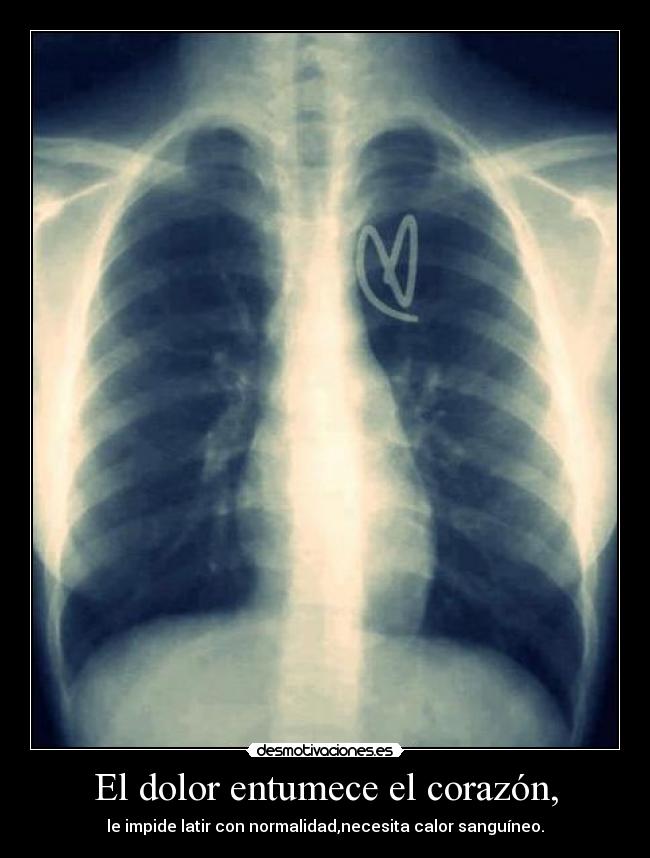 El dolor entumece el corazón, - le impide latir con normalidad,necesita calor sanguíneo.