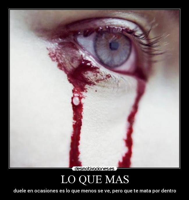 LO QUE MAS - duele en ocasiones es lo que menos se ve, pero que te mata por dentro