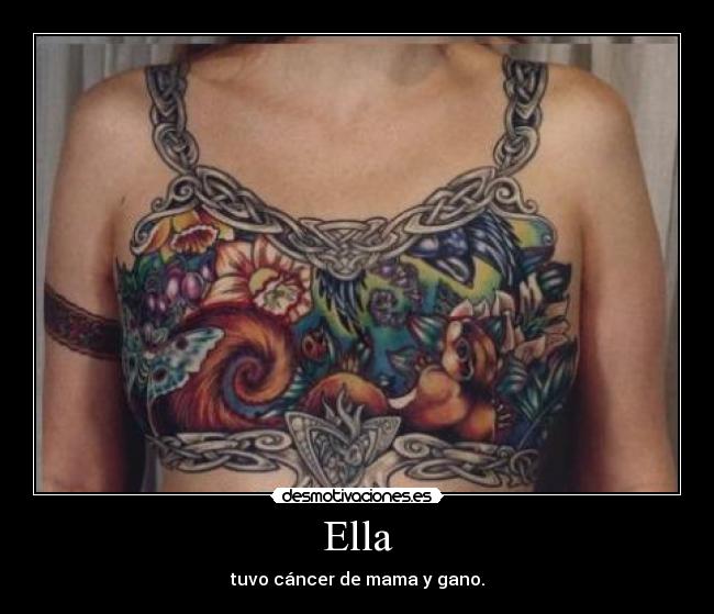 Ella - tuvo cáncer de mama y gano.