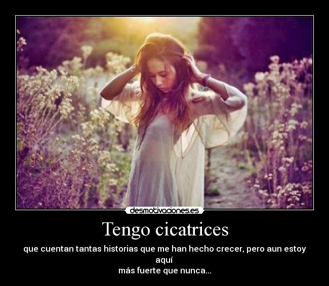 Tengo cicatrices - que cuentan tantas historias que me han hecho crecer, pero aun estoy aquí
más fuerte que nunca...